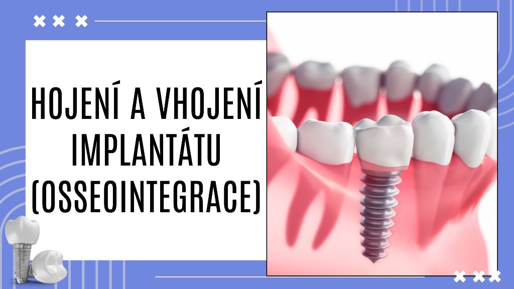 Hojení a vhojení implantátu (osseointegrace)