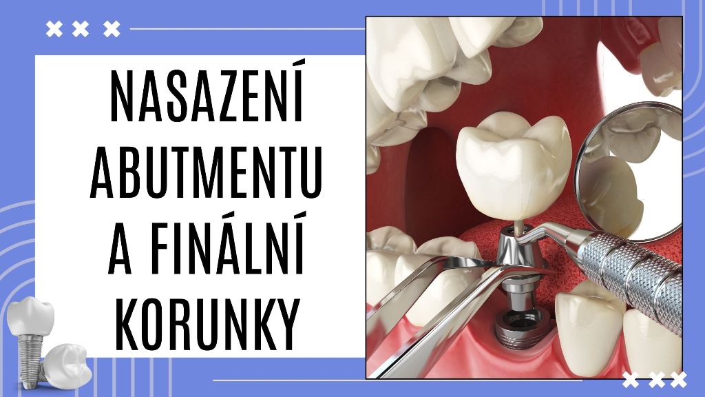 Nasazení abutmentu a finální korunky
