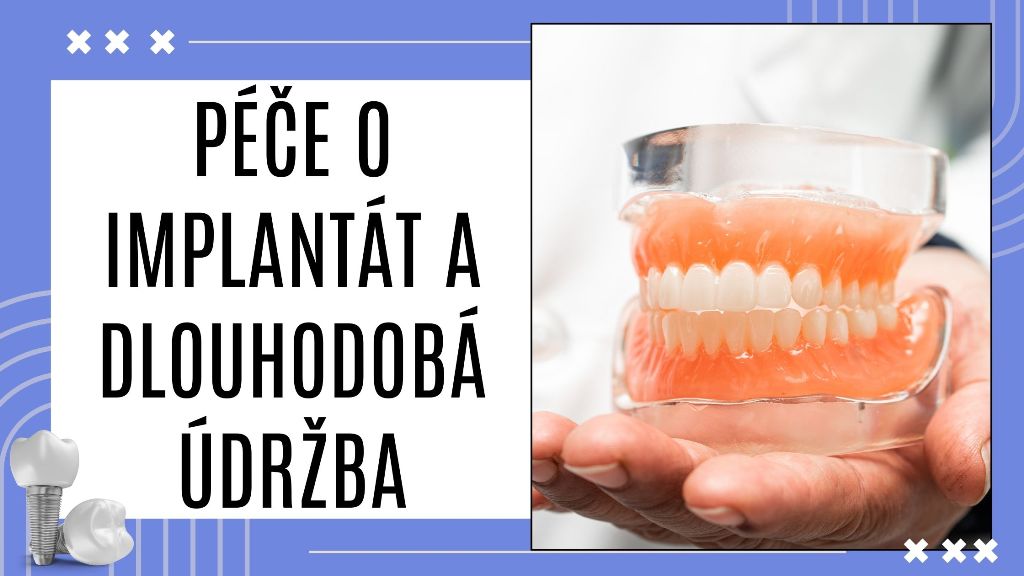 Péče o implantát a dlouhodobá údržba