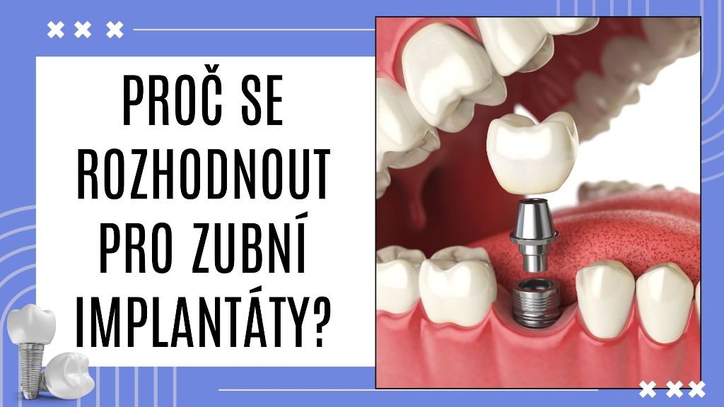 Proč se rozhodnout pro zubní implantáty