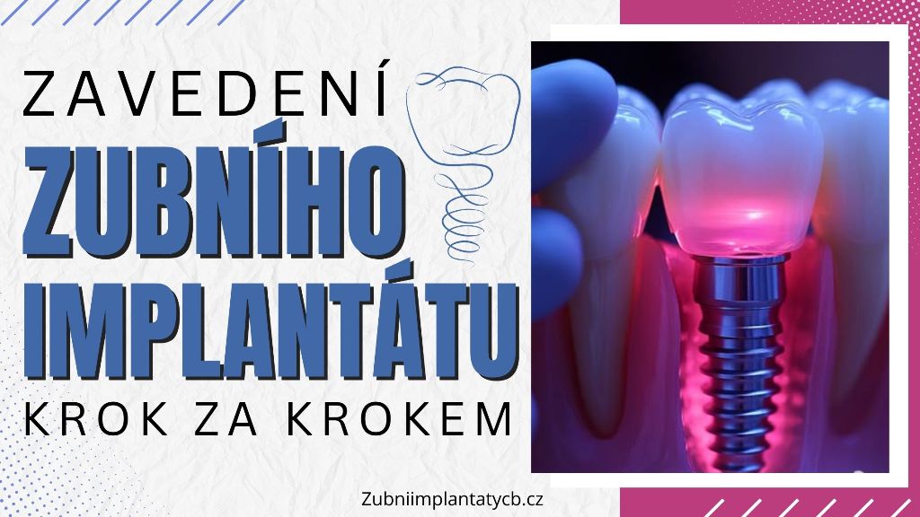 Zavedení zubního implantátu krok za krokem