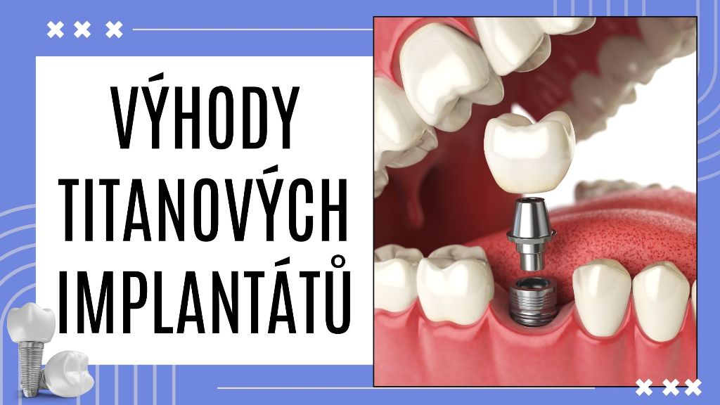 Výhody titanových implantátů