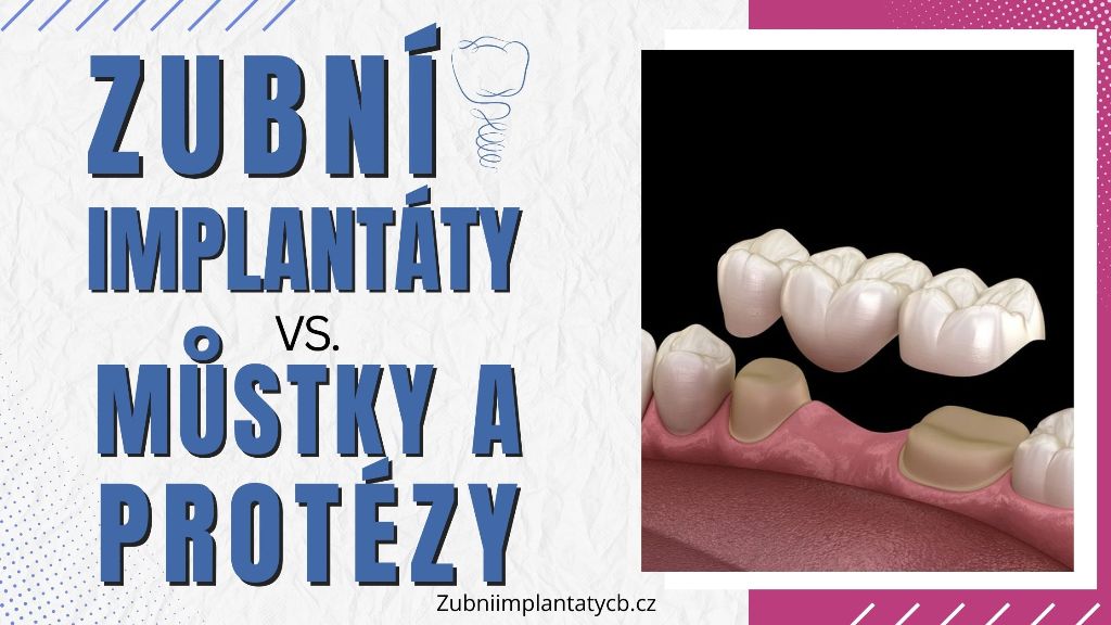 Zubní implantáty vs. můstky a protézy