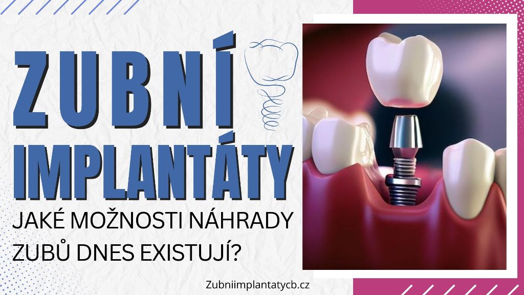 Zubní implantáty: Jaké možnosti náhrady zubů dnes existují?