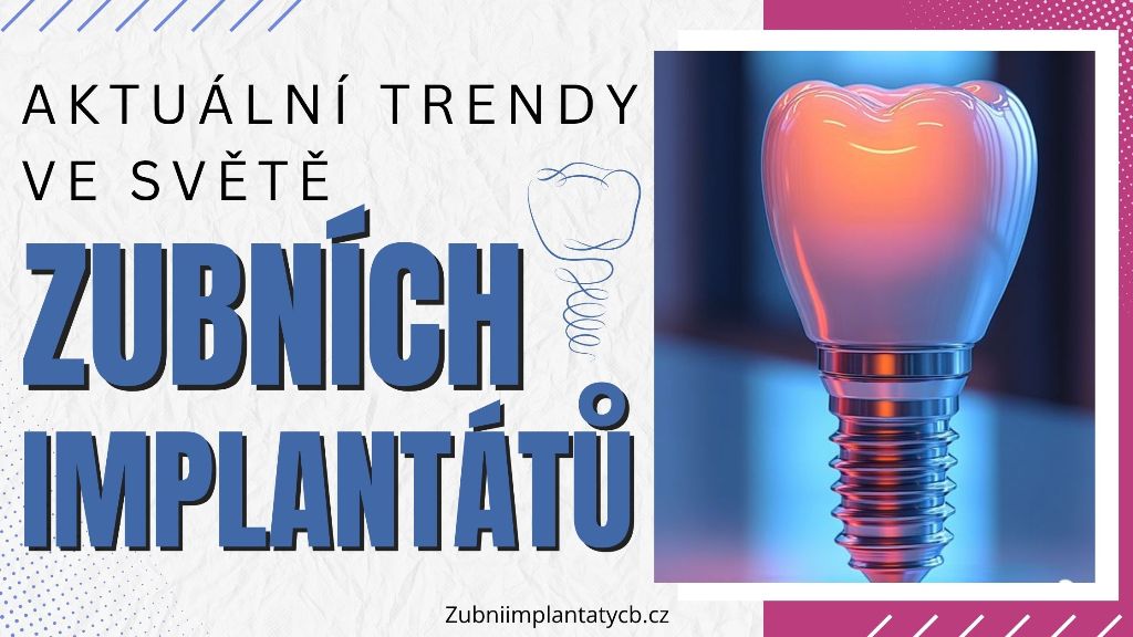 Aktuální trendy ve světě zubních implantátů