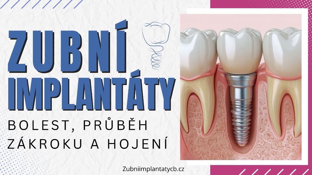 Zubní implantáty – bolest, průběh zákroku a hojení