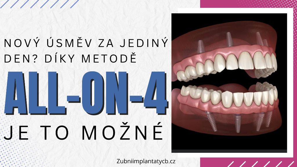 Nový úsměv za jediný den_ Díky metodě All-on-4 je to možné