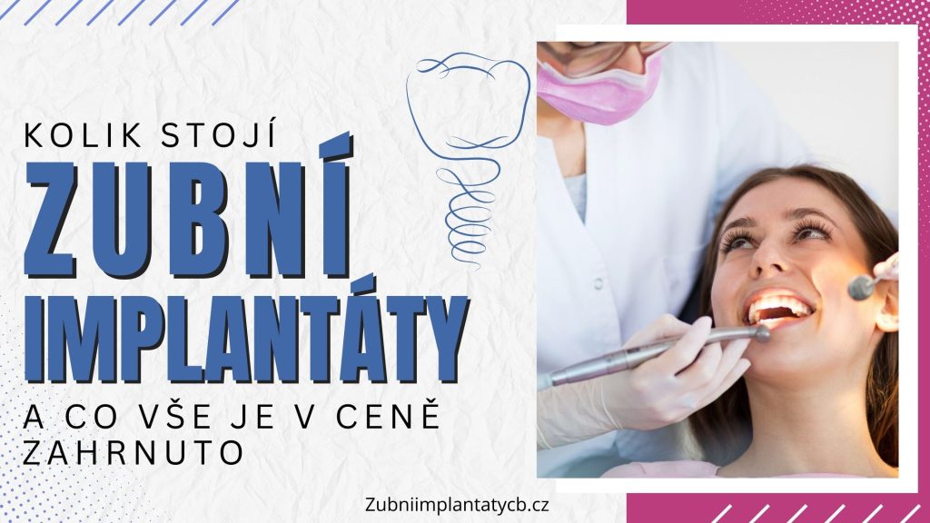Kolik stojí zubní implantáty a co vše je v ceně zahrnuto