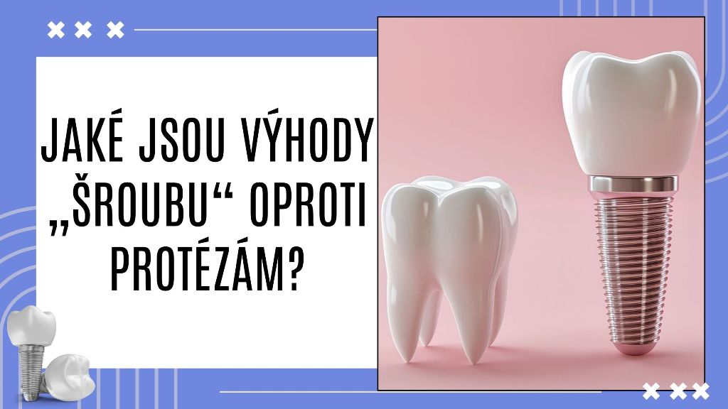 Jaké jsou výhody „šroubu“ oproti protézám?