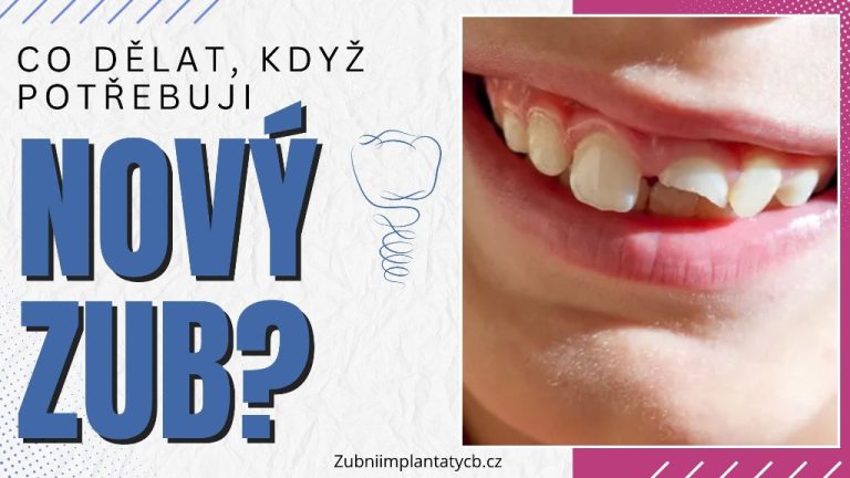 Co dělat, když potřebuji nový zub?