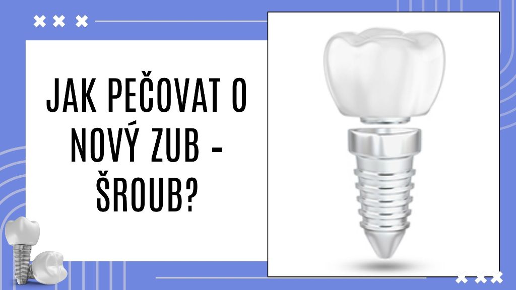 Jak pečovat o nový zub – šroub?